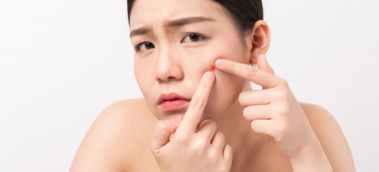 picture of a teen with acne